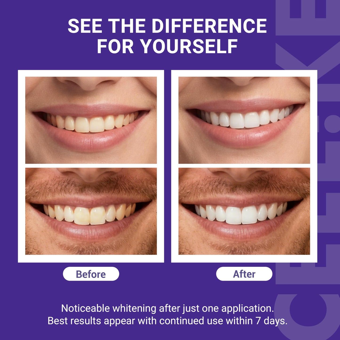 CEELIKE Purple Teeth Whitening 14 Strips (7 Treatments)